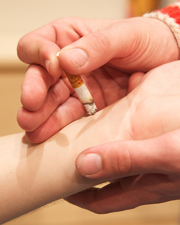 Cigarette Burn